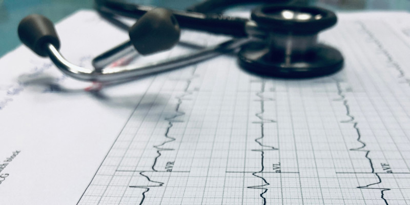 EKG Exam – It records the electrical signal from your heart to check for different heart conditions. 