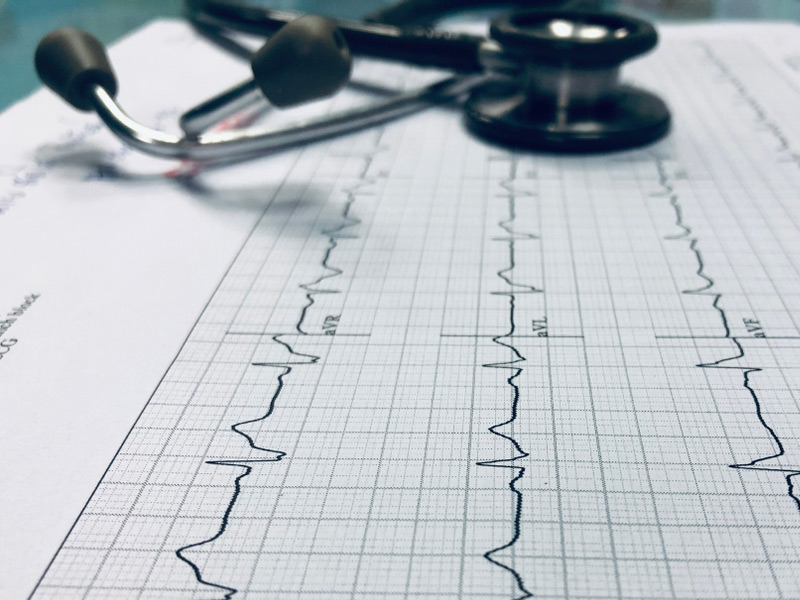 EKG Exam – It records the electrical signal from your heart to check for different heart conditions.